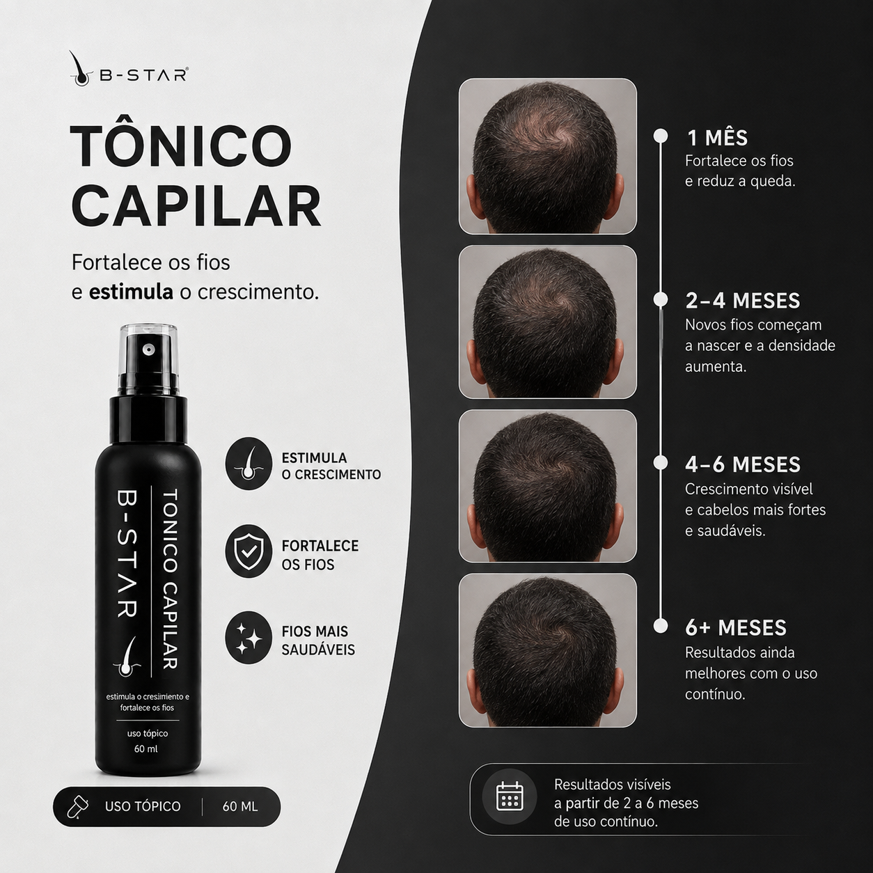 Comece hoje a recuperar a densidade do seu cabelo.